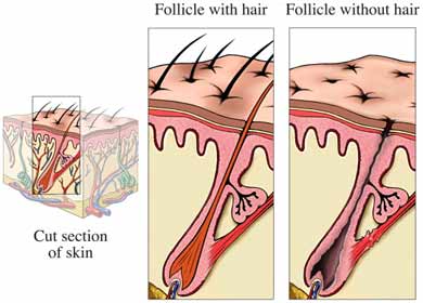 Hair Removal Permanent
